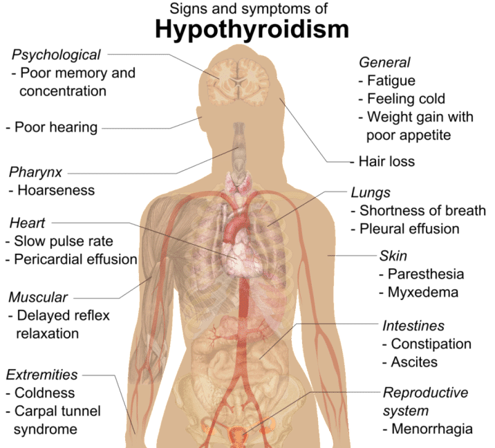a study on hypothyroidism symptoms and treatment of the disease a study on hypothyroidism symptoms and treatment of the disease